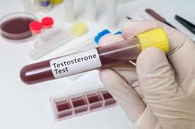 This trace mineral is critical for the overall function of the male reproductive system and is required for successful spermatogenesis. 5 Of The Best Testosterone Supplements And Some Natural Boosters