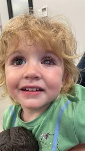 Does anyone's baby have eyes like my baby? Does it have a proper medical  name? How do you care for it? Ever since I brought him home as a puppy, his  left