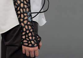 The Osteoid Created By Turkish Student Deniz Karasahin Incorporates 3d Printing And Ultrasonic Tech To Make Healing Wearable Technology Bone Healing It Cast