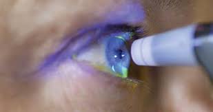 Image result for Intraocular Pressure
