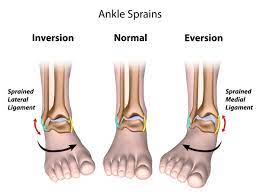 How To Strengthen Your Ankle After A Sprain | Lower Extremity Review  Magazine