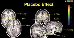 Image result for Placebo Effect