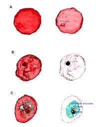 The data we will use in our project consists of cell images under the microscope. Tomocube Microscope Advances Malaria Research
