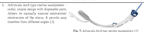 See what tawny advincula (flipkid) has discovered on pinterest, the world's biggest collection of ideas. Pdf Low Cost Adaptive Uterine Manipulator For Pelvic Laparoscopic Surgery Semantic Scholar