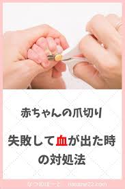 赤ちゃんの爪切りに失敗 血が出たときの対処法について経験者が語ります ママへのアドバイス 子育て 赤ちゃん