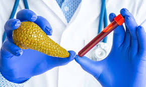 Image result for Lipase