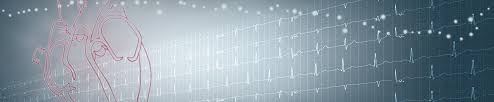 Episodes of atrial fibrillation may come and go, or. Adris Groupe De Rythmologie Interventionnelle Lyon