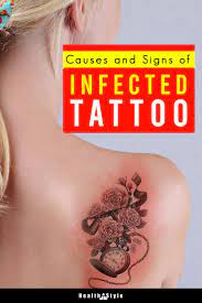 Causes And Signs Of Infected Tattoo Infected Tattoo Tattoo Oil Tattoos