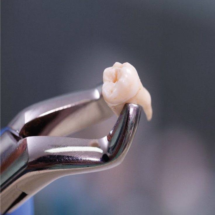 Oral surgery product image