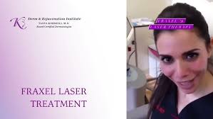 Best Fraxel treatment in Santa Monica, Best dermatologist in Santa Monica 3
