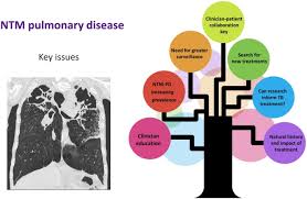Non Tuberculous Mycobacteria Pulmonary Disease Patients And Clinicians Working Together To Improve The Evidence Base For Care International Journal Of Infectious Diseases