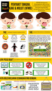 Savesave apa itu hfmd for later. Penyakit Tangan Kaki Dan Mulut Hfmd Punca Dilemma Si Ibu Beranak Kecil