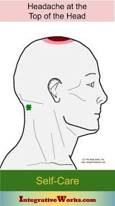 Pin On Headache Trigger Point Pain