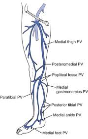 Gastrocnemius vein anatomy elegant evidence for treatment of. Varicose Veins Thoracic Key