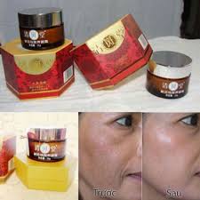 Birth control, pregnancy and hormone therapy can all trigger melasma. Japanese Melasma Cream For Night Use 30gm Work 7days Shopee Malaysia