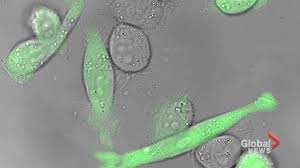 Messages online claim that a simple home pregnancy test can detect testicular cancer in men. Testicular Cancer Survivor Warns Others I Never Thought I D Get It In My 20s National Globalnews Ca