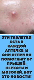 средство от прыщей на лице для подростков в домашних условиях Eti Tabletki Est V Kazhdoj Aptechke I Oni Otlichno Pomogayut Ot Pryshej Perhoti I Mozolej Vot Eto Novosti Lechenie Perhoti Perhot Lechenie Pryshej