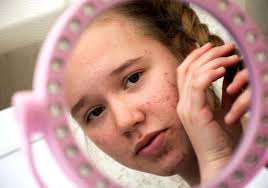 When is it okay to start treating acne in kids? Here's what you need to  know 👇 Shop my SLMD Skincare by Dr. Pimple Popper back-to-school promotion  going