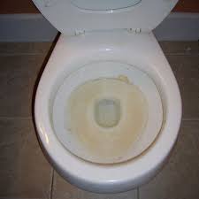 Tipps Stark Verschmutzte Toilette Reinigen Bei Westfalia Versand Deutschland