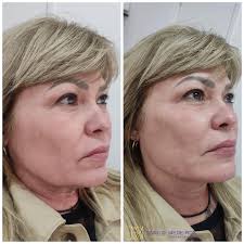 Danilo Medeiros Souza(@drdanilomedeirossouza) • Instagram写真と動画