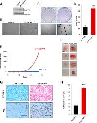 Competent cells are bacterial cells commonly used for transformation. Vopp1 Induces Cell Transformation In Vitro And Tumorigenesis In Vivo A Download Scientific Diagram