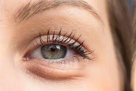 Cara mengatasi mata bengkak yang natural ialah dengan menghindari mengucek mata. 4 Cara Lenyapkan Kantong Di Bawah Mata Halaman All Kompas Com