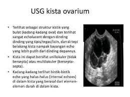 Kista Tumor Jinak Yang Terbungkus Selaput Jaringan Dan Berisi Cairan Bisa Tumbuh Di Rahim Sal Telur Indung Telur Celestial Celestial Bodies Body