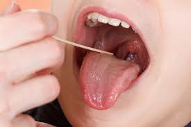 What Is Tonsillitis Arizona Desert Ear Nose Throat Specialists