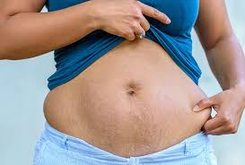The most effective way to get rid of postpartum loose skin is through body contouring surgery. How To Tighten Loose Skin On Stomach After Pregnancy Theblessedmom