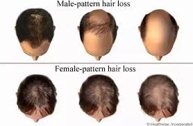 The estrogen can also help reduce excess hair. Do Transgender Women Grow Natural Feminine Hair Without A Wig Quora