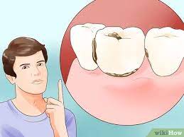 If your bottom teeth extend past your top ones, you have an abnormal bite that. How To Determine If You Need Braces With Pictures Wikihow