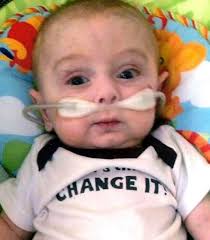 Collin Rice Obituary