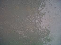 Our old house has calcimine ceilings which prevented paint from sticking. Chipping Cracking Layers Of Paint Possible Calcimine Diy Home Improvement Forum
