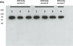 Der neue ist ein alter bekannter. Frontiers Integration Of The B Cell Receptor Antigen Neurabin I Samd14 Into An Antibody Format As New Therapeutic Approach For The Treatment Of Primary Cns Lymphoma Oncology