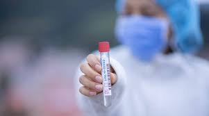 Dann ab auf ein konzert! False Negatives And False Positives In Covid 19 Cases Find Out What They Are Lifestyle News The Indian Express