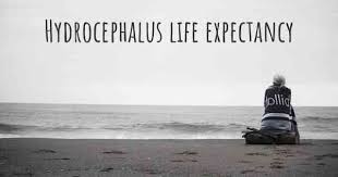 What Is The Life Expectancy Of Someone With Hydrocephalus