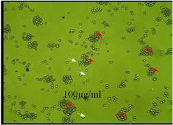 Image result for Sarcocephalus pobeguinii