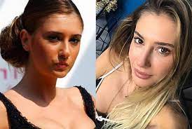 Badem Goz Estetigi Nedir Ve 2019 Yili Fiyatlari Badem Gozler Gozler Badem