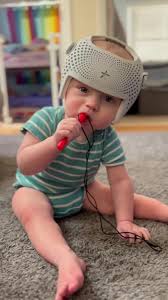 هل خوذة علاج الرأس المسطح آمنة على نمو الطفل؟