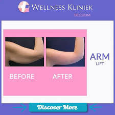 Pin On Top Ways To Lose 34 Pounds