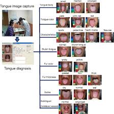 Standard Processing Flowchart For Tongue Diagnosis