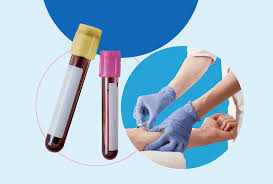 Image result for Screening Test