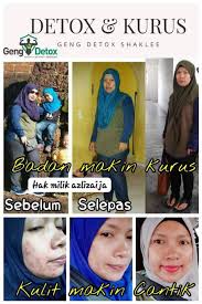 Okey so first of all kita ke basic aa ataupun aa akak kenapa seseorang itu boleh naik berat badan ataupun boleh dapat masalah obesiti? Cara Nak Kuruskan Badan Dan Perut Buncit Kedai Vitamin Butterworth