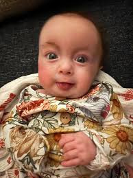 ✨ Today is one of my top favorite memories of Eloise 🥹 One year ago today  a little sassy girl ripped her NG tube out at 4 in the morning and we