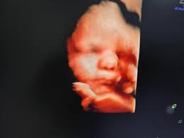 Awesome to see this in Bristol:)