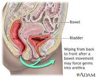 Image result for how long does it take to get rid of bacterial bladder infection without treatment