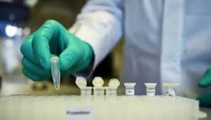 Apr 03, 2020 · covid 19 coronavirus: New Zealand Extends Auckland Coronavirus Lockdown Australia Case Numbers Slow World News Zee News