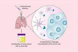 New Sensors Could Offer Early Detection Of Lung Tumors Mit News Massachusetts Institute Of Technology