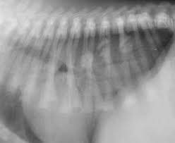 Image result for Pulmonary Contusion
