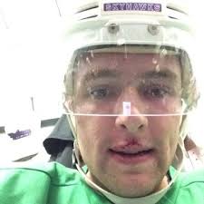 Connor Fallon (@cousintweeter9)